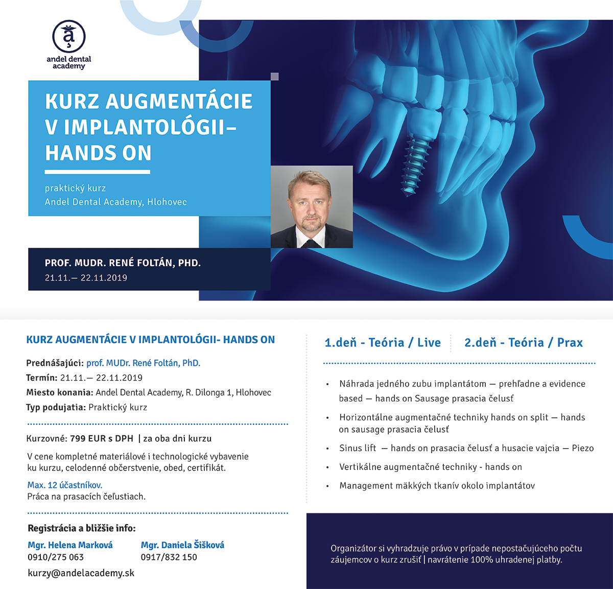 Kurz augmentace v implantologii – HANDS ON (Hlohovec / Slovensko) 21.11.2019